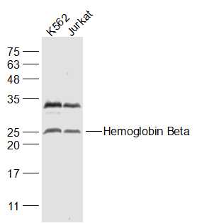 Hemoglobin Beta Rabbit pAb(bs-