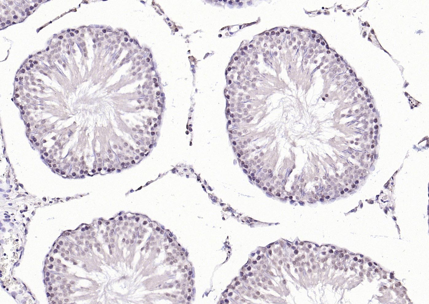 HSF1 Rabbit pAb(bs-3757R)-50ul