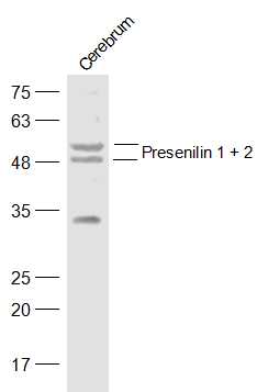 Presenilin 1 + 2 Rabbit pAb(bs