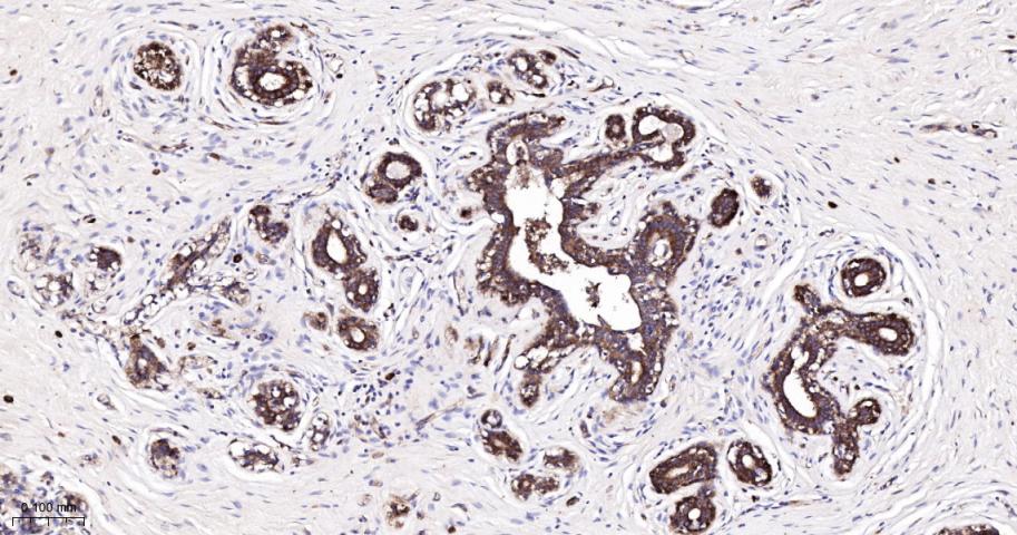 EEF1A1 Recombinant Rabbit mAb(