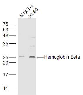 Hemoglobin Beta Rabbit pAb(bs-