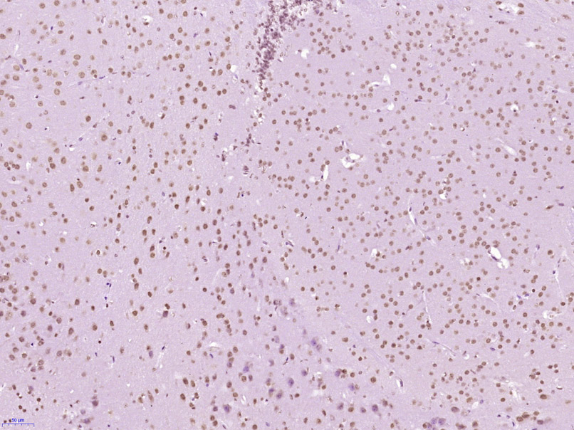 TBP Rabbit pAb(bs-11766R)-50ul