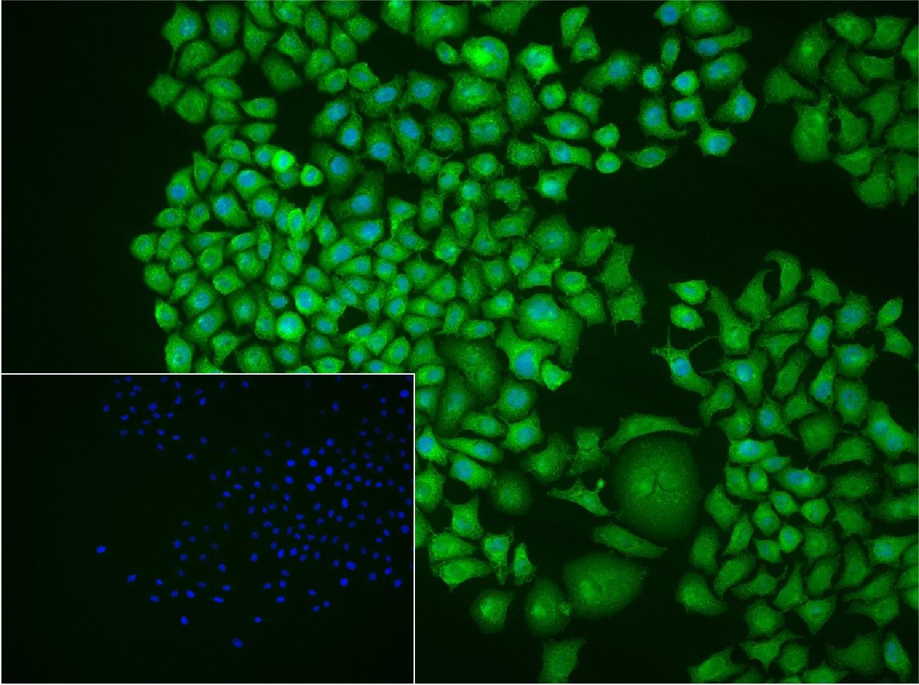 COMMD1 Rabbit pAb(bs-8034R)-50