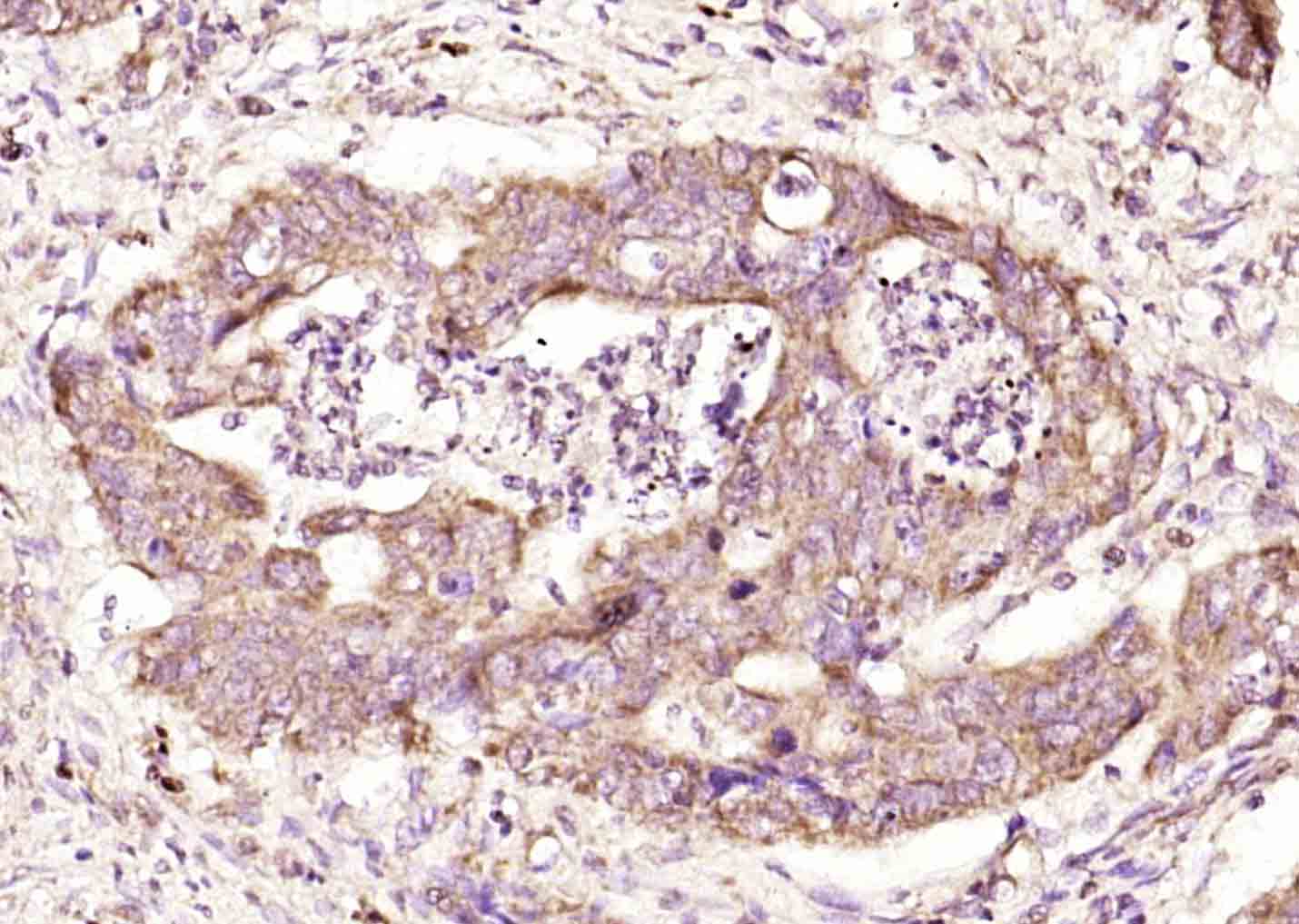 phospho-eIF4EBP1 (Thr36) Rabbi