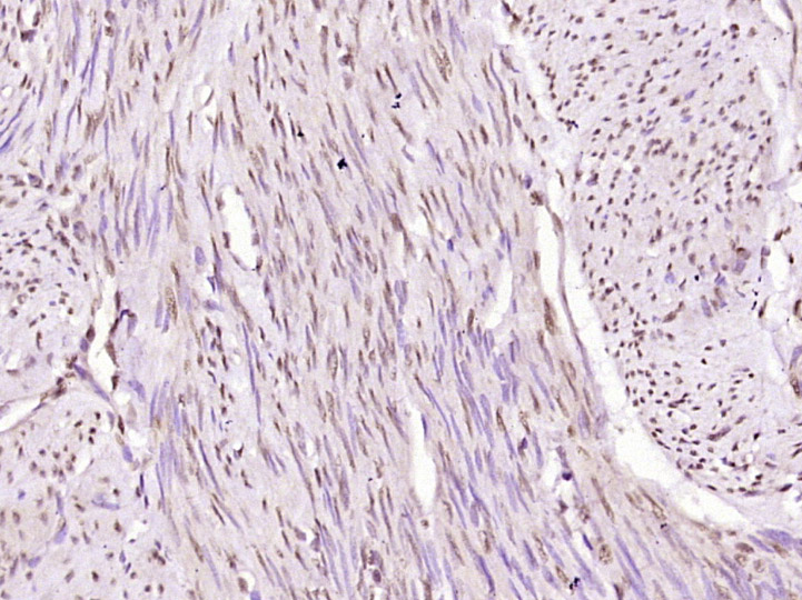 NFKB p65 (Acetyl-Lys314/Lys315