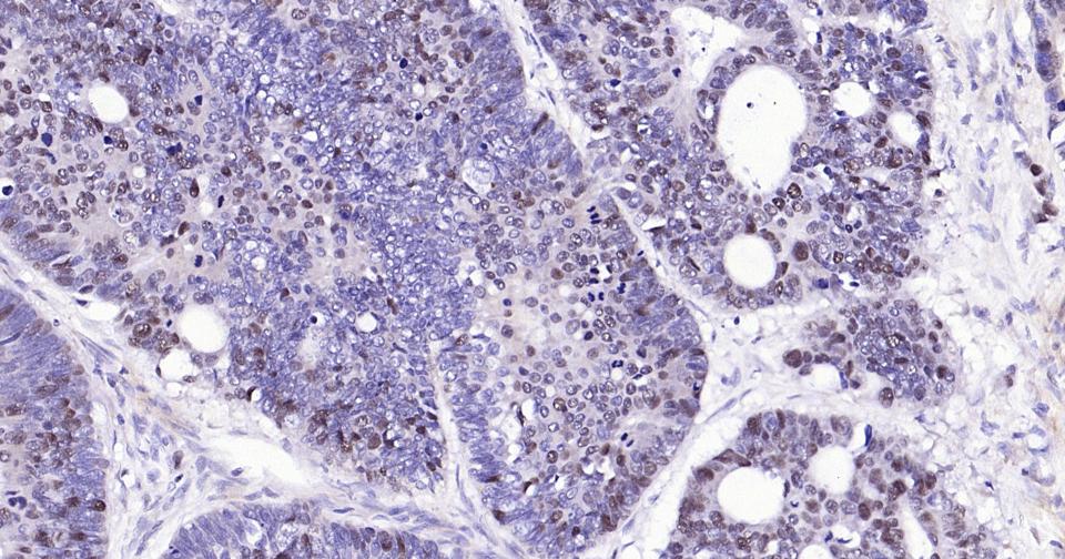 PCNA Rabbit pAb(bs-10889R)-50u