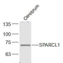 SPARCL1 Rabbit pAb(bs-6110R)-5