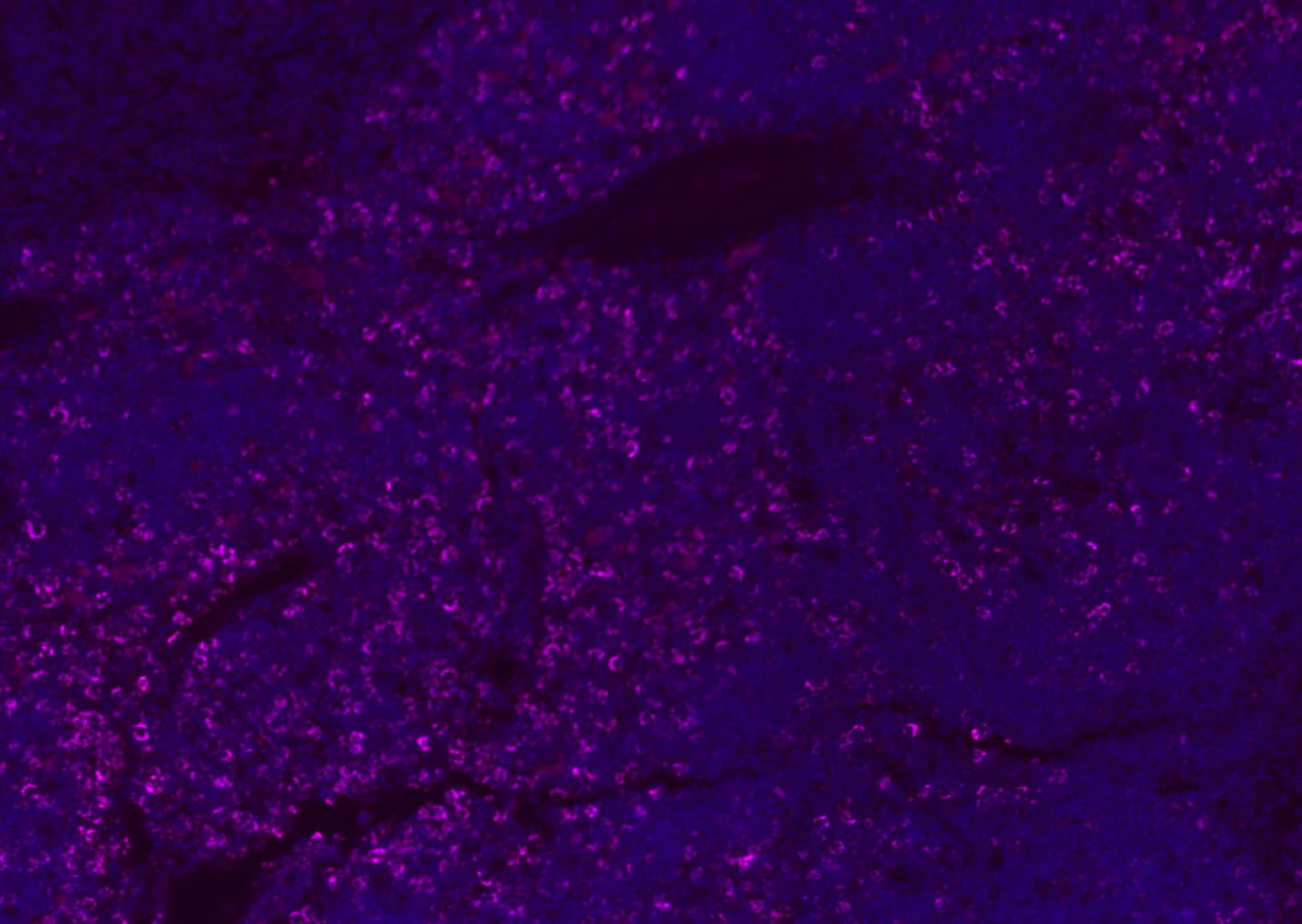 CD8B Rabbit pAb(bs-4914R)-50ul