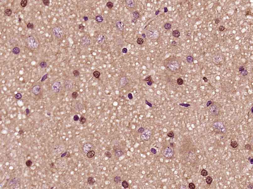 PFKFB3/PFK2 Rabbit pAb(bs-1263