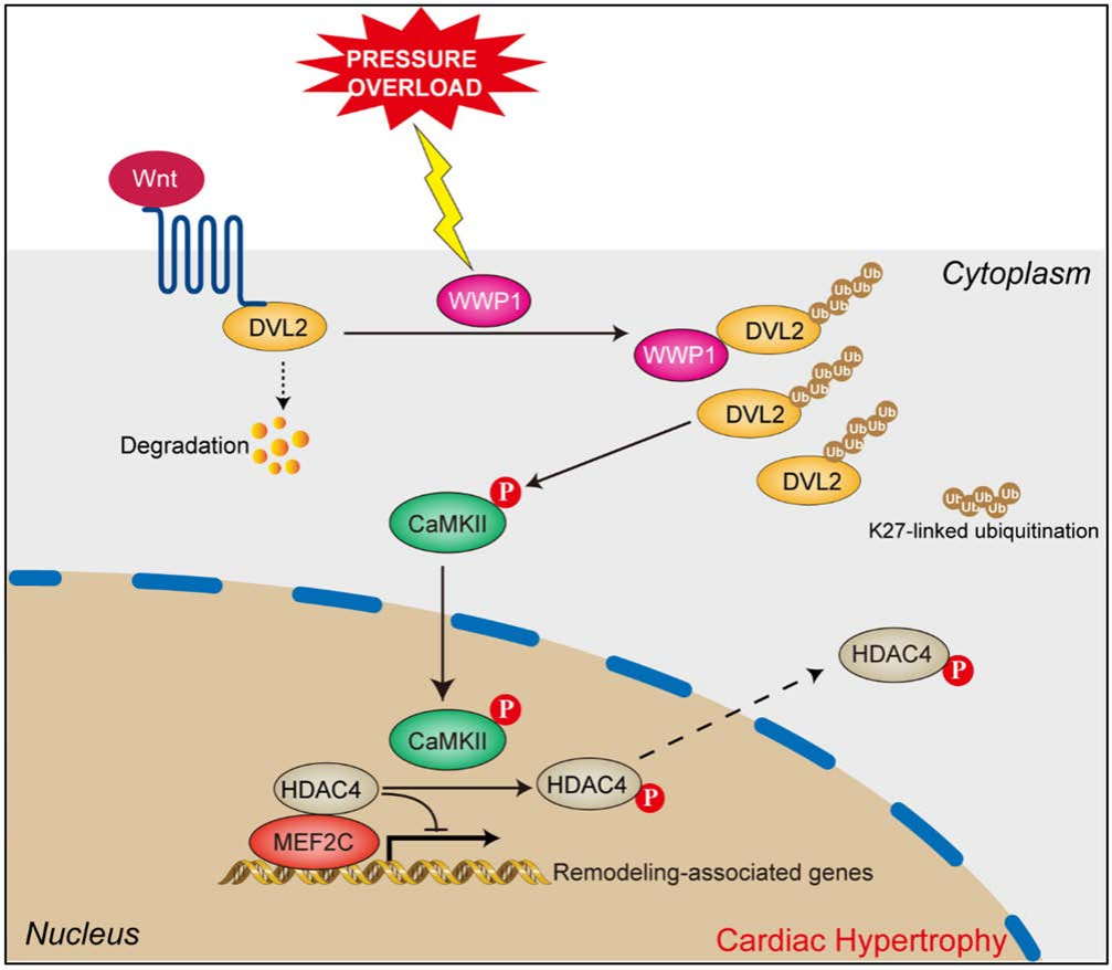 IF=23.603【AAV在心脏疾病中的应用】科学家揭示病理性心肌肥厚及心力衰竭治疗的潜在靶点