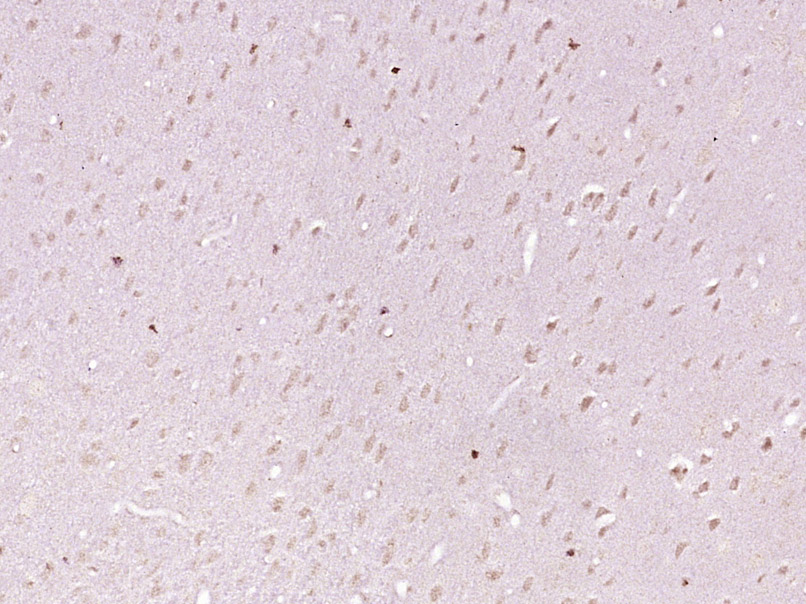 KIAA1755 Rabbit pAb(bs-17029R)