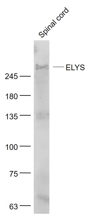 ELYS Rabbit pAb(bs-9880R)-50ul