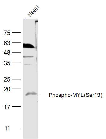 phospho-MYL (Ser19) Rabbit pAb