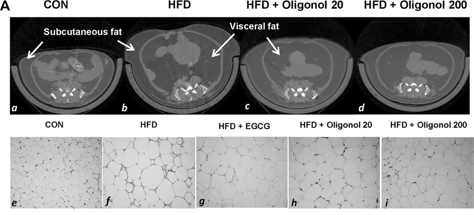 肥胖机制研究.png 肥胖机制研究.png