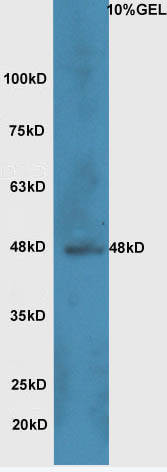 Wnt8b Rabbit pAb(bs-6245R)-50u