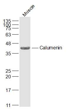CALU Rabbit pAb(bs-6658R)-50ul