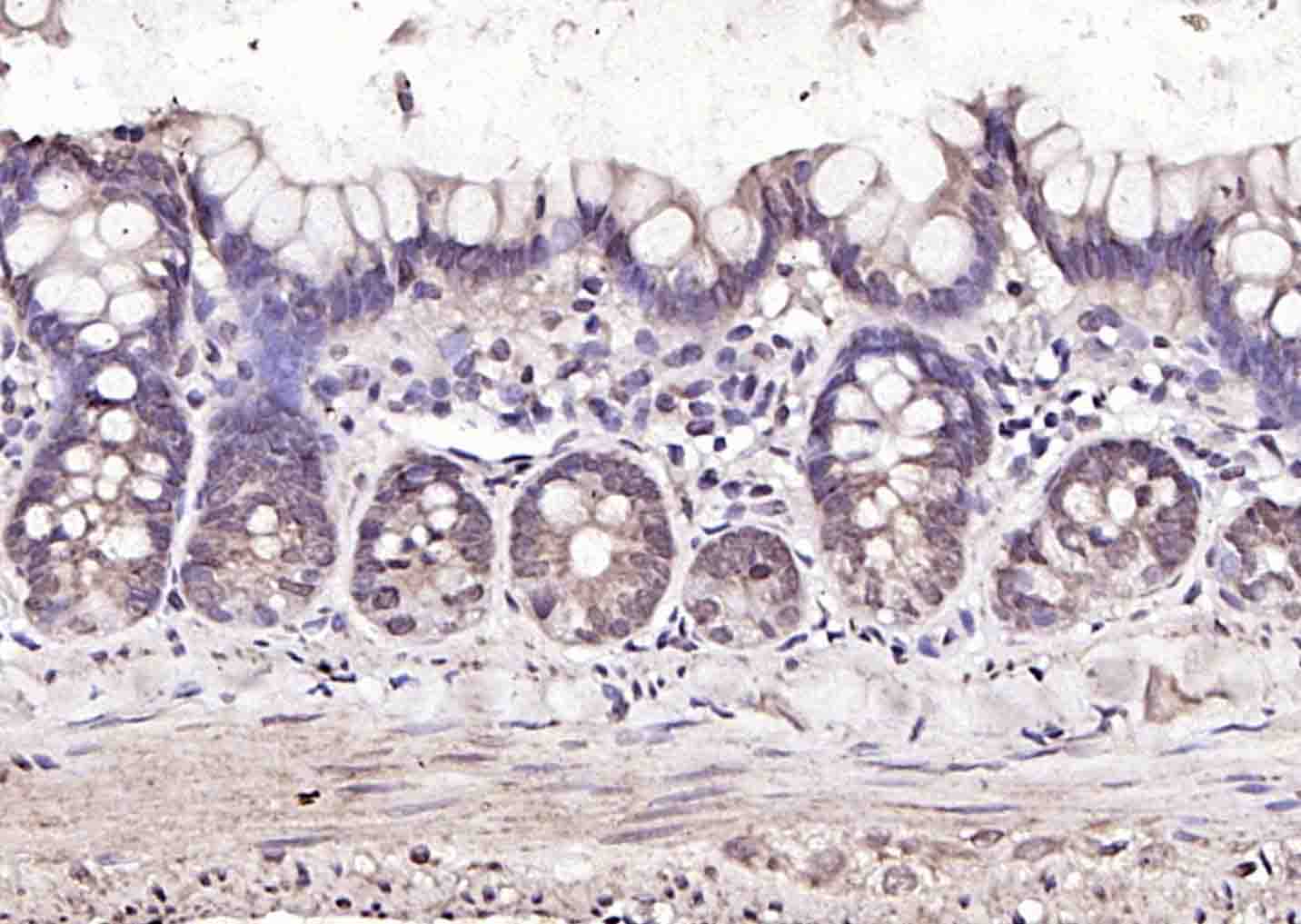 GATA2 Rabbit pAb(bs-6616R)-50u
