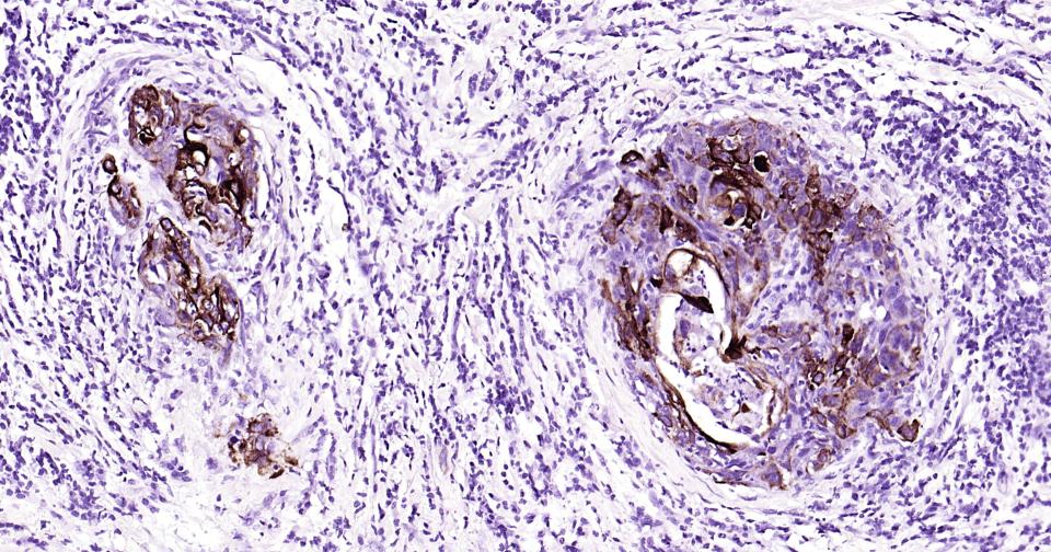 Cytokeratin 14 Recombinant Rab