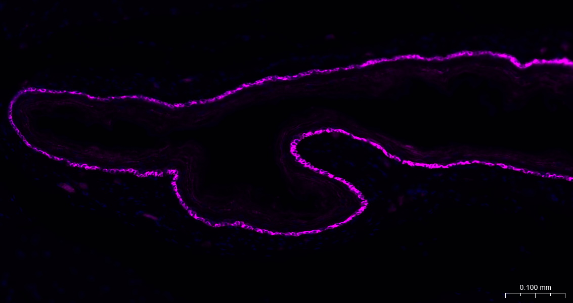 Cytokeratin 14 Recombinant Rab
