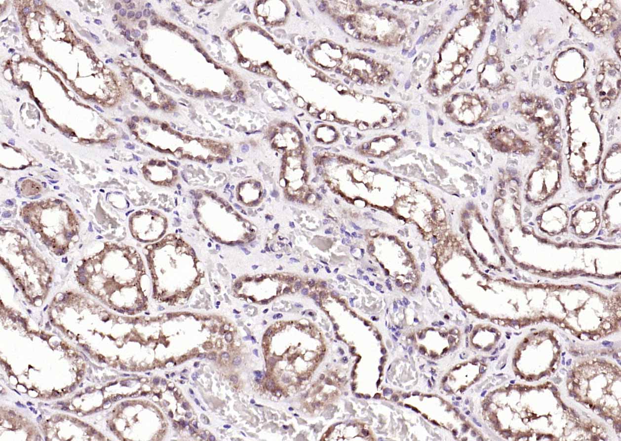 ANKRD54 Rabbit pAb(bs-20549R)-