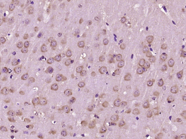 Glutathione Transferase zeta 1