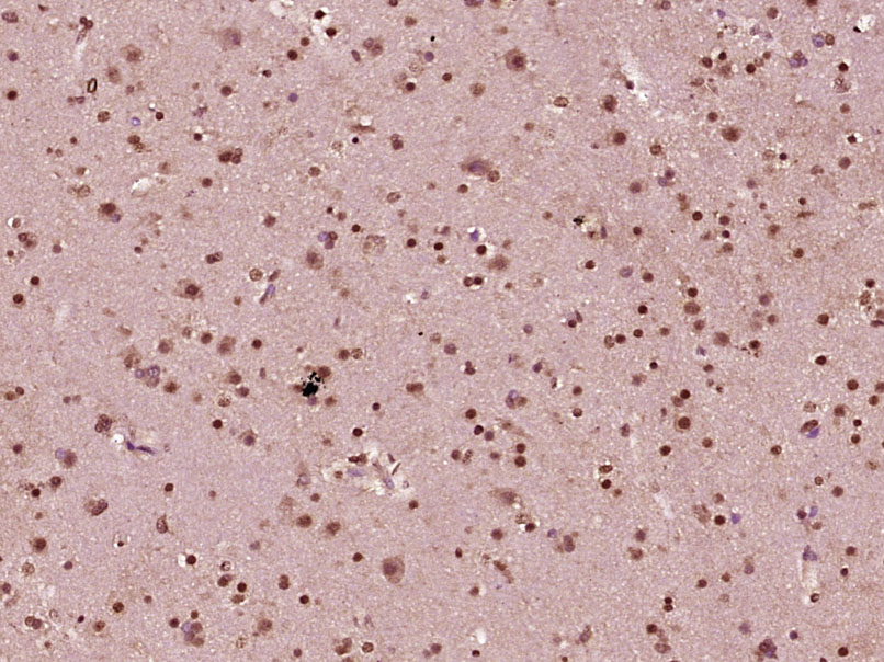 HSF1 Rabbit pAb(bs-3757R)-50ul