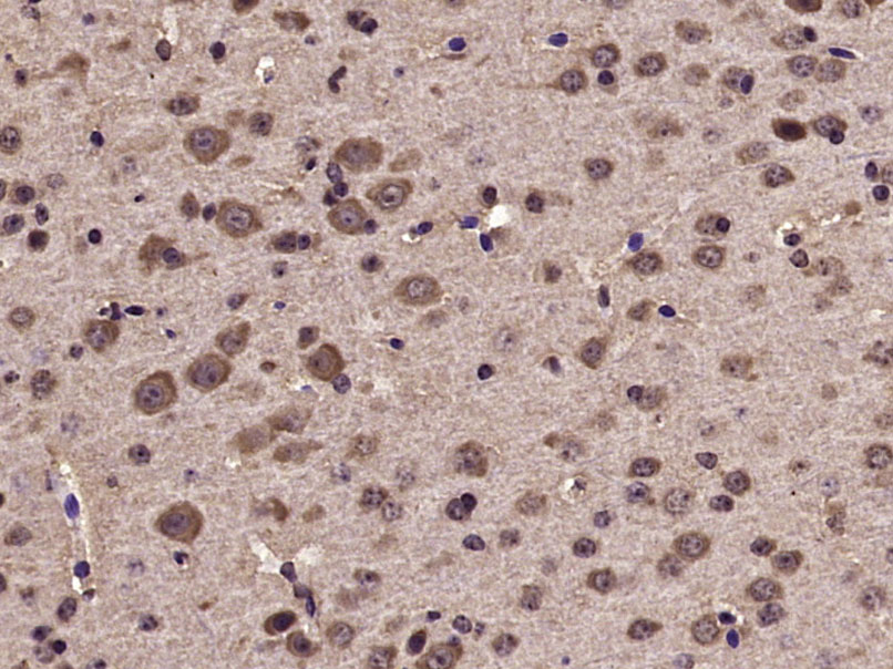 phospho-Tyk2 (Tyr1054 + Tyr105