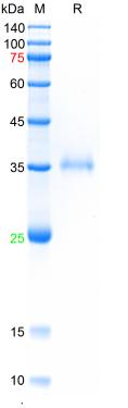Recombinant SARS-Cov-2 Spike R