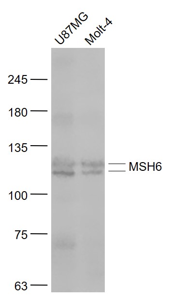 MSH6 Rabbit pAb(bs-3804R)-50ul