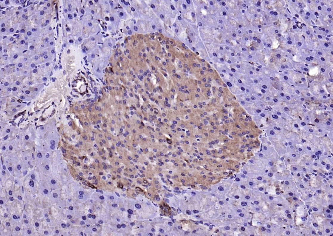 LSM3 Rabbit pAb(bs-18428R)-50u