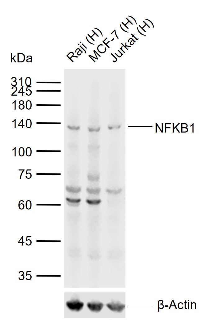 NFKB1 Rabbit pAb(bs-1194R)-50u