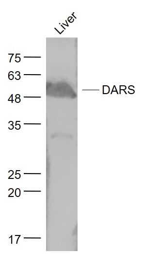 DARS Rabbit pAb(bs-14197R)-50u