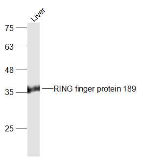 RING finger protein 189 Rabbit