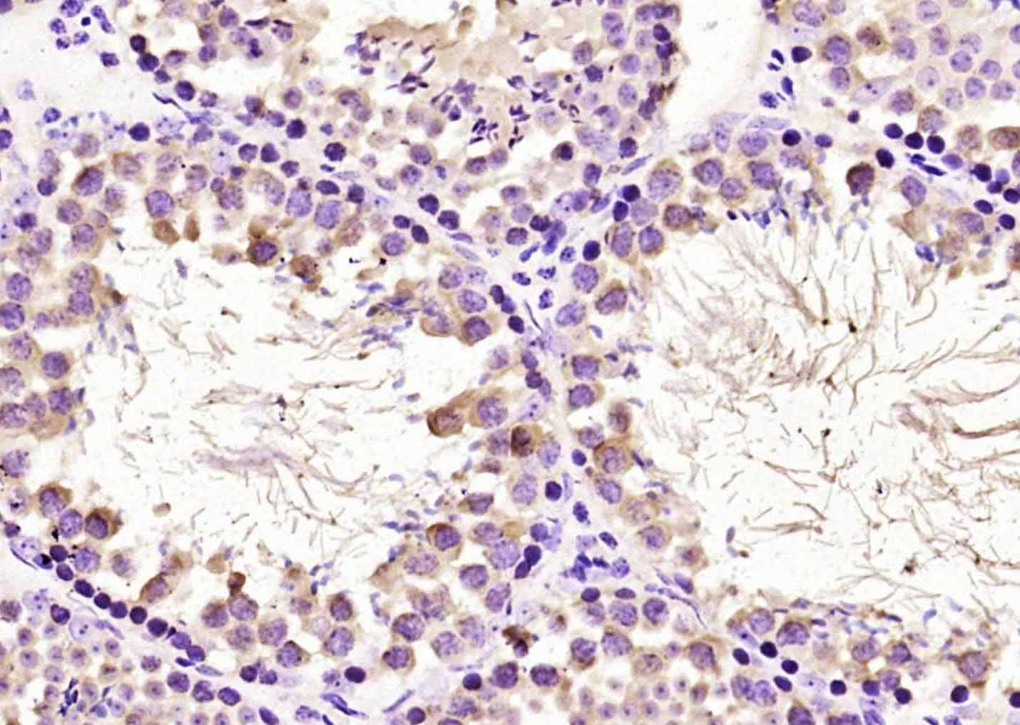 CCDC46 Rabbit pAb(bs-8133R)-50