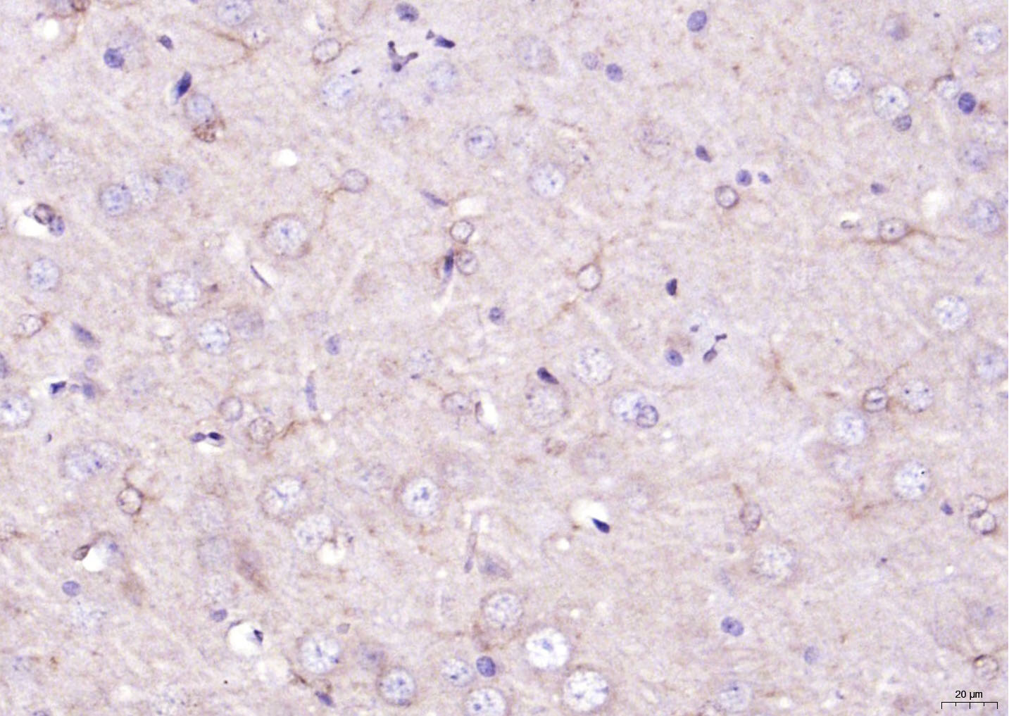 Versican Rabbit pAb(bs-2533R)-