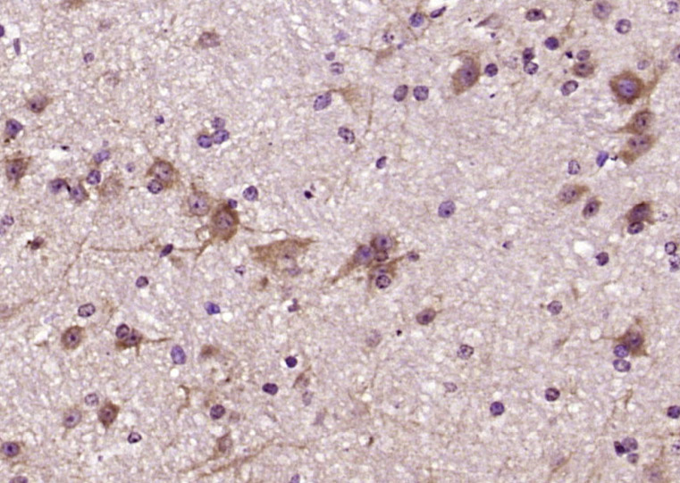 RTN1 Rabbit pAb(bs-11798R)-50u