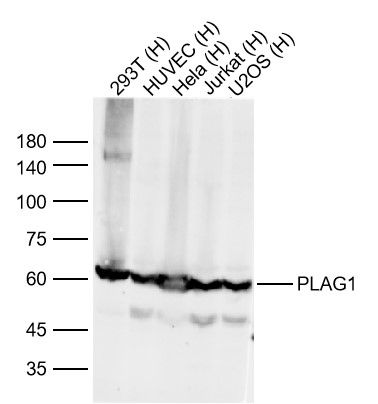 PLAG1 Rabbit pAb(bs-10092R)-50