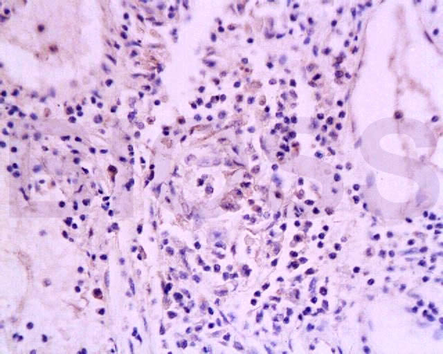 TNFRSF18 Rabbit pAb(bs-1173R)-