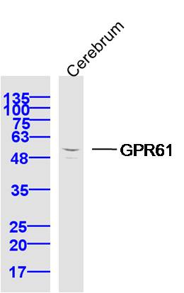 GPR61 Rabbit pAb(bs-16295R)-50