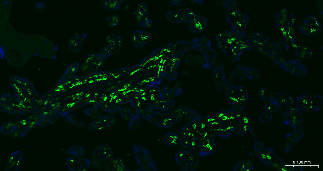 CD163 Rabbit pAb(bs-2527R)-50u