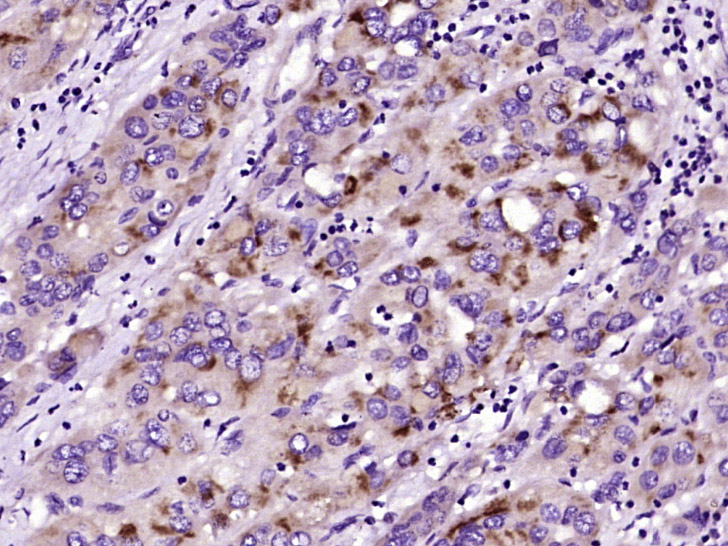 Phospholipase C beta 2 Rabbit 