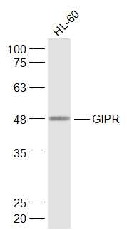 GIPR Rabbit pAb(bs-13292R)-50u