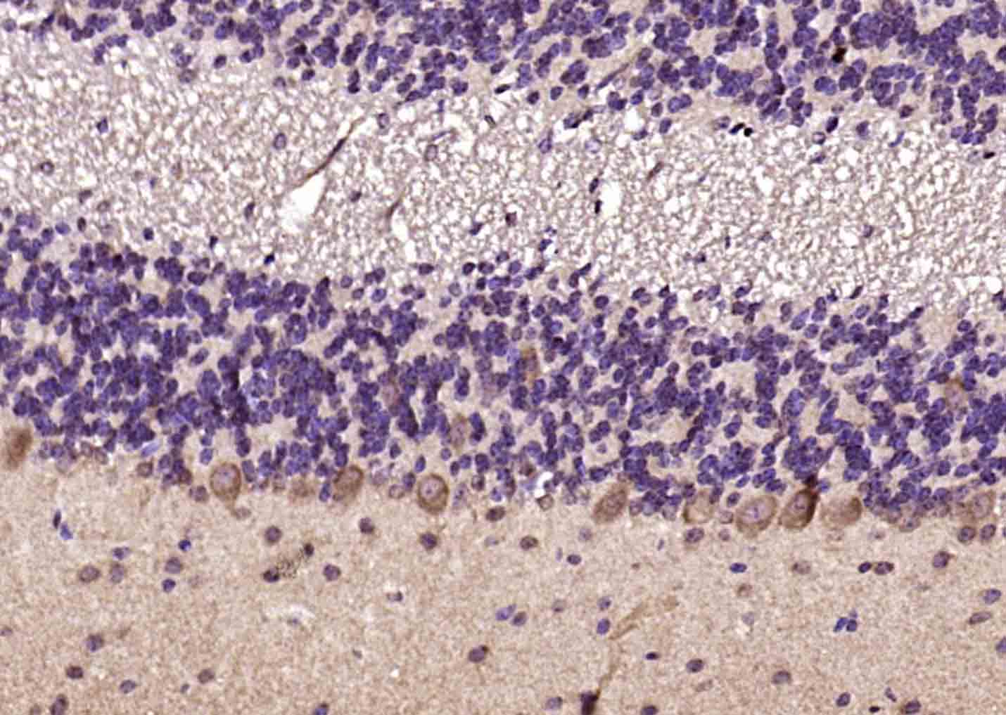 ANKS6 Rabbit pAb(bs-9099R)-50u