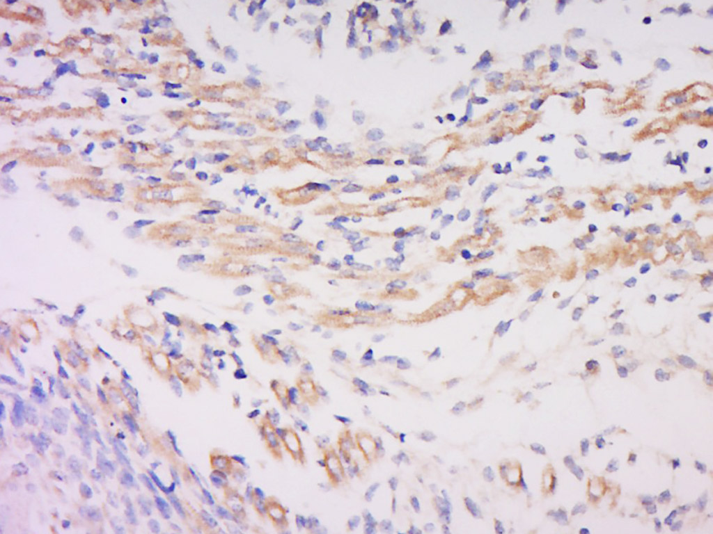 GJA8 Rabbit pAb(bs-13364R)-50u