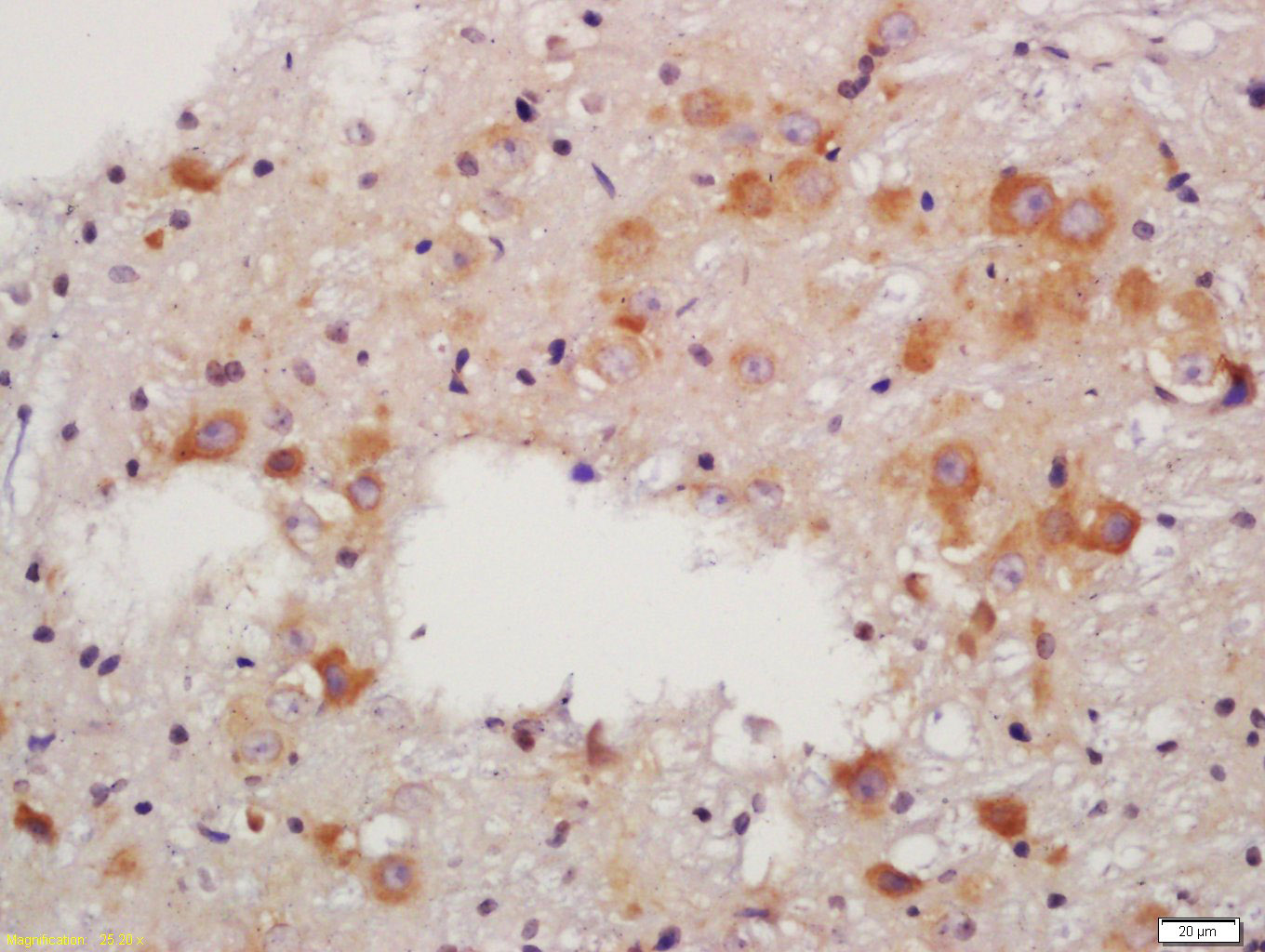 ALDH1A2 Rabbit pAb(bs-3676R)-5