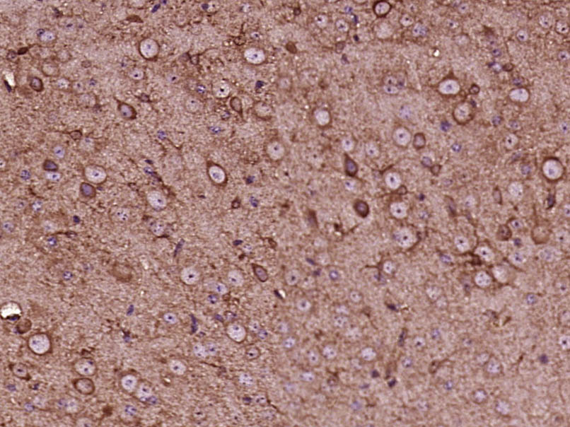 EXOC8 Rabbit pAb(bs-14665R)-50