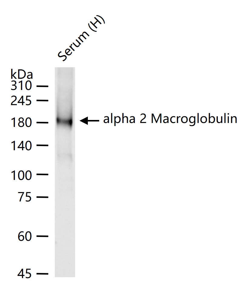 alpha 2 Macroglobulin Rabbit p