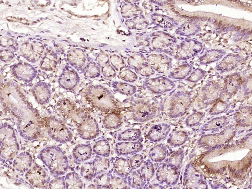 MSH6 Rabbit pAb(bs-3804R)-50ul