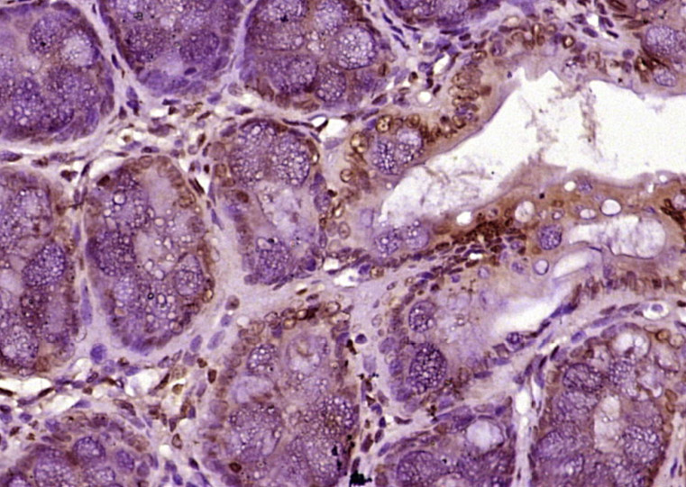 MATR3 Rabbit pAb(bs-5141R)-50u