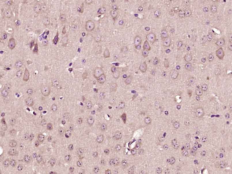 FITM2 Rabbit pAb(bs-16091R)-50